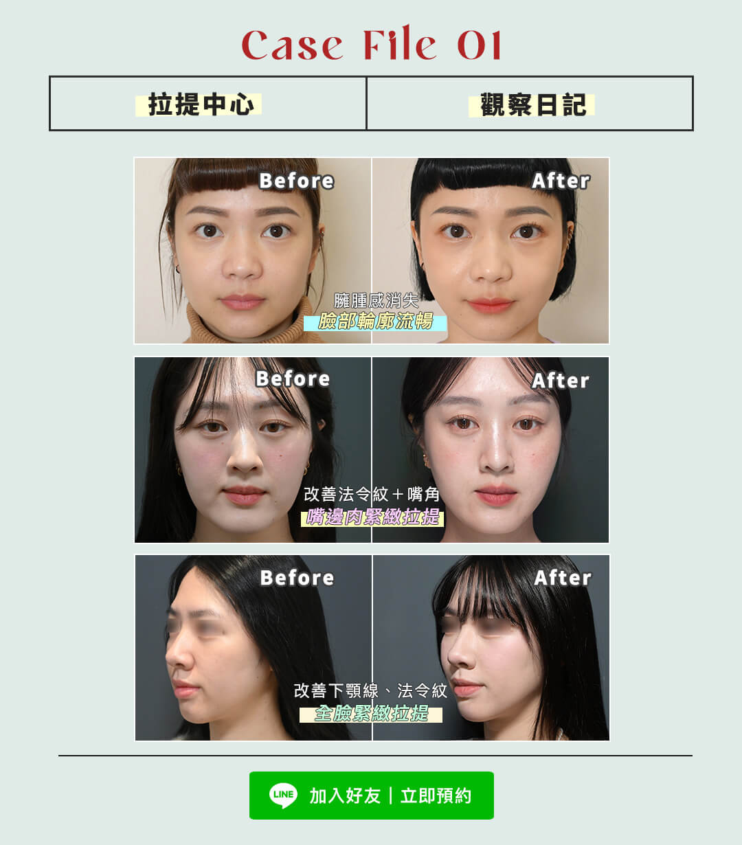 美貌誕生紀實:拉提中心|觀察日記